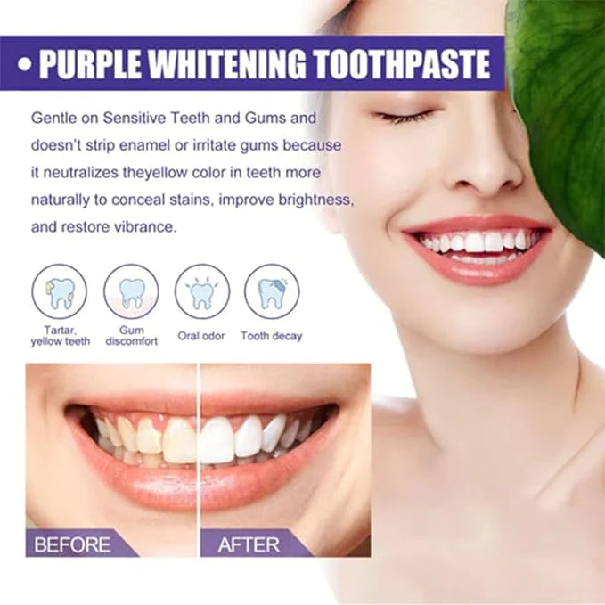 معجون تبييض الأسنان | Teeth Whitening Toothpaste