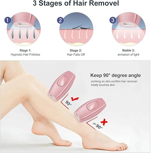 إزالة الشعر بالليزر المصغر | Mini Laser Hair Removal