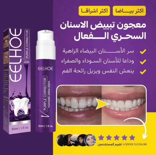 معجون تبييض الأسنان | Teeth Whitening Toothpaste